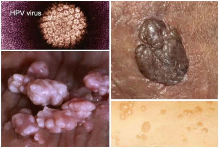 STD Testing Kit | STD Testing at Home From ProDx